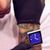 Foto bij iPod nano als lichaamsimplantaat